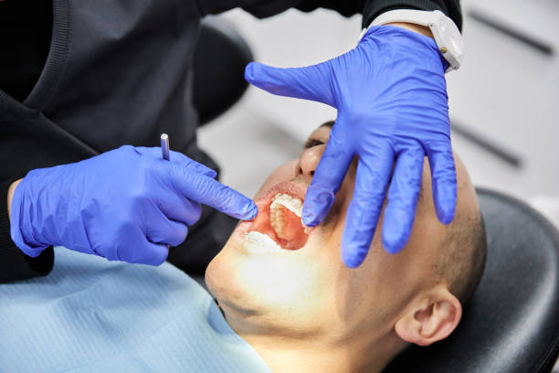 Best Dental Abscess Treatment in Rolling Hills, CA
